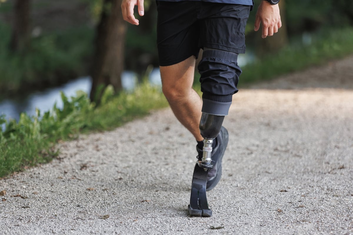Man with a disability using a versatile prosthetic leg walking along the greenway during daily recreation